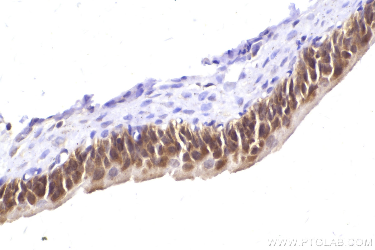 Immunohistochemistry (IHC) staining of rat bladder tissue using OSBPL3 Polyclonal antibody (12417-1-AP)