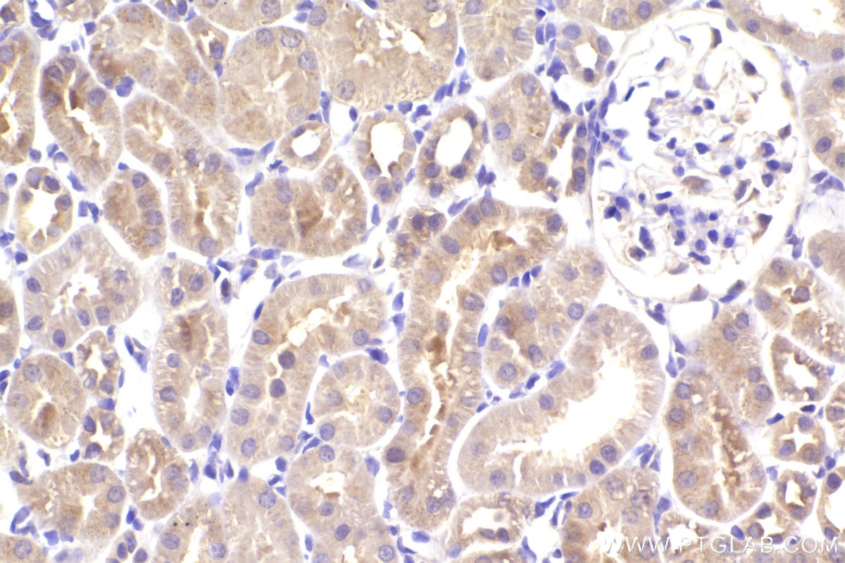 Immunohistochemistry (IHC) staining of rat kidney tissue using OSBPL3 Polyclonal antibody (12417-1-AP)