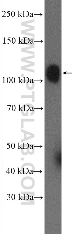 Western Blot (WB) analysis of K-562 cells using OSBPL3 Polyclonal antibody (12417-1-AP)
