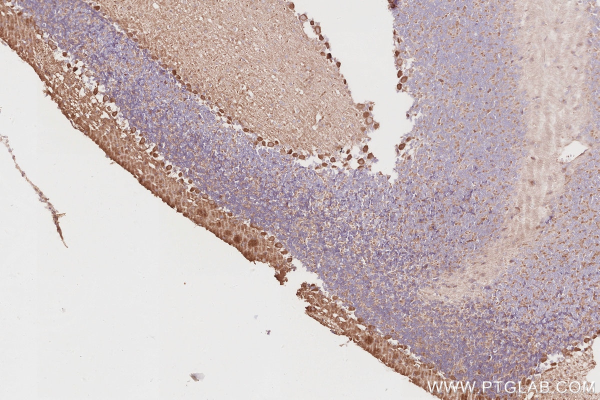 Immunohistochemistry (IHC) staining of mouse cerebellum tissue using OSBPL5 Polyclonal antibody (27870-1-AP)