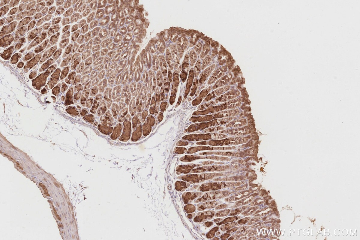 Immunohistochemistry (IHC) staining of mouse stomach tissue using OSBPL5 Polyclonal antibody (27870-1-AP)