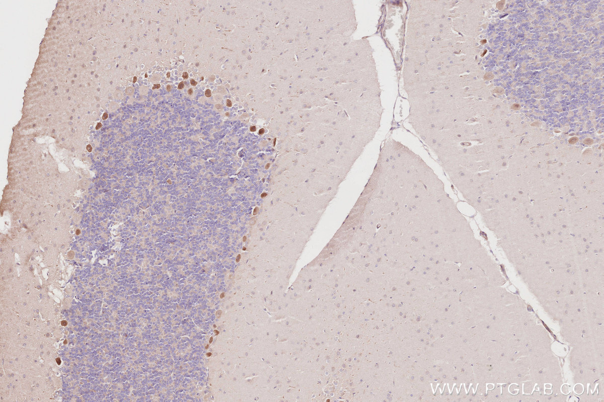 Immunohistochemistry (IHC) staining of rat cerebellum tissue using OSBPL5 Polyclonal antibody (27870-1-AP)