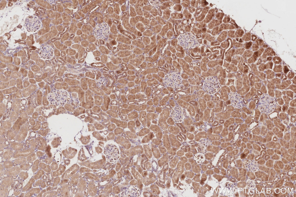 Immunohistochemistry (IHC) staining of rat kidney tissue using OSBPL5 Polyclonal antibody (27870-1-AP)