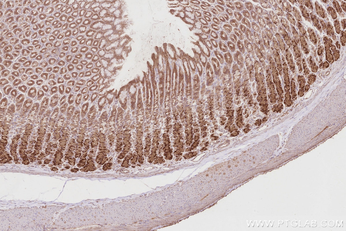 Immunohistochemistry (IHC) staining of rat stomach tissue using OSBPL5 Polyclonal antibody (27870-1-AP)