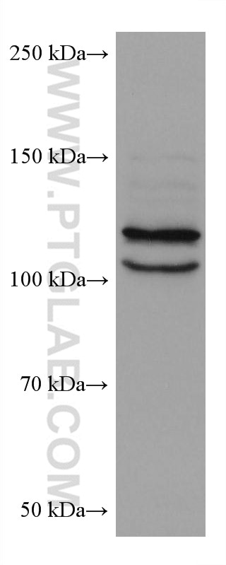 Western Blot (WB) analysis of LNCaP cells using OSBPL5 Monoclonal antibody (67913-1-Ig)