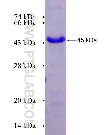 OSBPL5 fusion protein Ag27304 SDS-PAGE