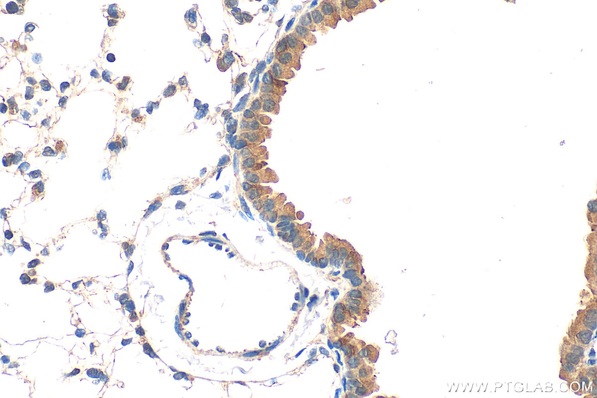 Immunohistochemistry (IHC) staining of mouse lung tissue using OSBPL6 Polyclonal antibody (32158-1-AP)