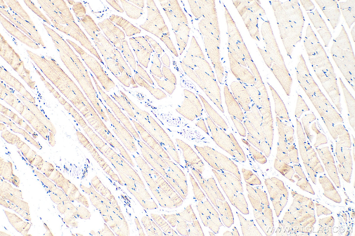 Immunohistochemistry (IHC) staining of mouse skeletal muscle tissue using OSBPL6 Polyclonal antibody (32158-1-AP)
