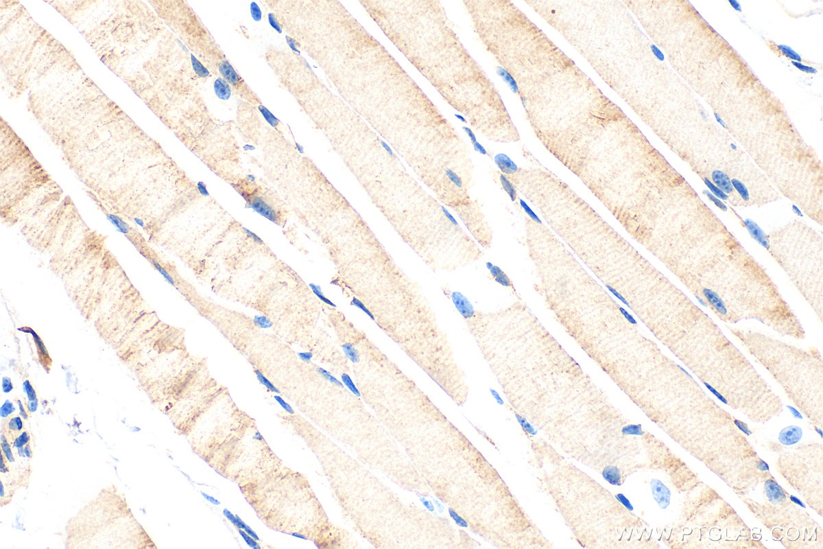Immunohistochemistry (IHC) staining of mouse skeletal muscle tissue using OSBPL6 Polyclonal antibody (32158-1-AP)