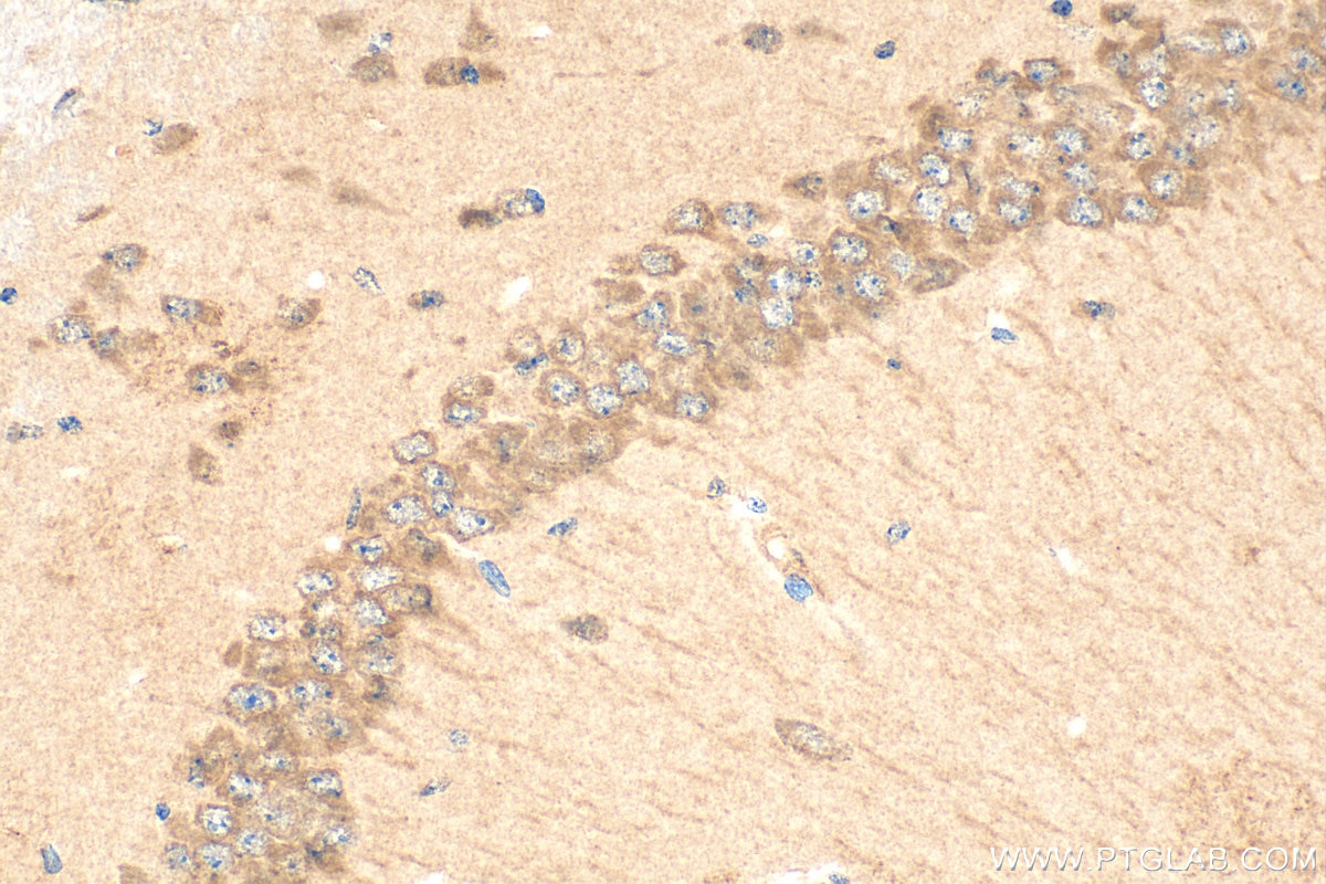 Immunohistochemistry (IHC) staining of mouse brain tissue using OSBPL6 Polyclonal antibody (32158-1-AP)