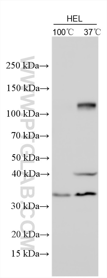 Western Blot (WB) analysis of various lysates using OSBPL6 Polyclonal antibody (32158-1-AP)
