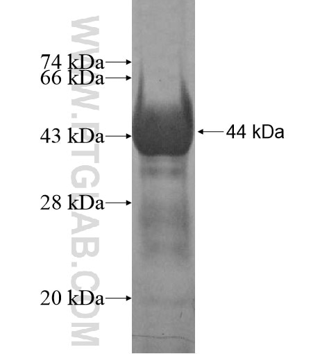 OSBPL7 fusion protein Ag11142 SDS-PAGE