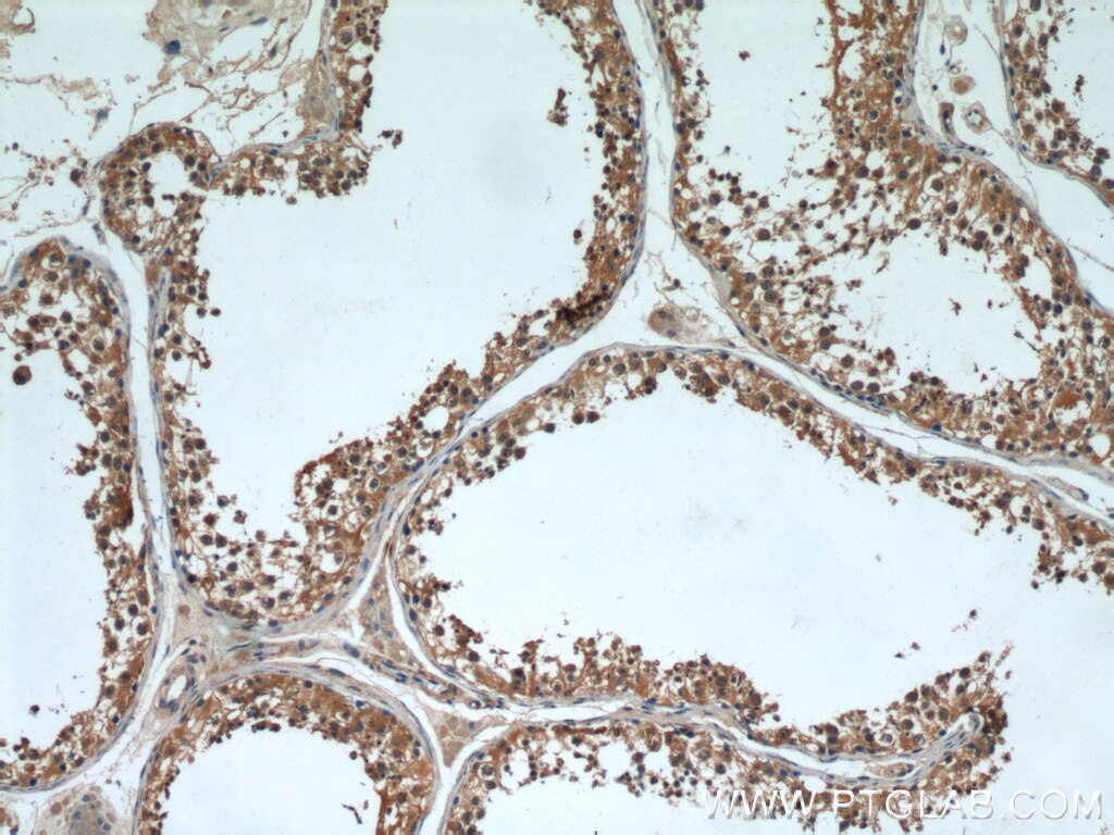 IHC staining of human testis using 11879-1-AP