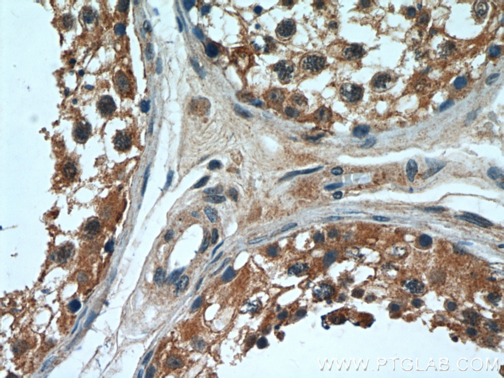 Immunohistochemistry (IHC) staining of human testis tissue using OSBPL9 Polyclonal antibody (11879-1-AP)