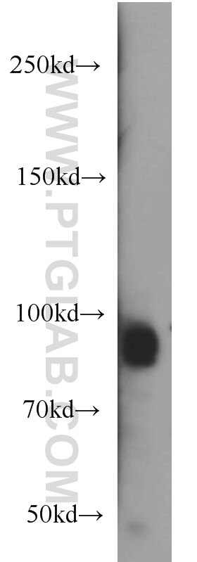 Western Blot (WB) analysis of human brain tissue using OSBPL9 Polyclonal antibody (11879-1-AP)