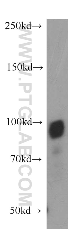 Western Blot (WB) analysis of mouse lung tissue using OSBPL9 Polyclonal antibody (11879-1-AP)