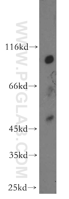 Western Blot (WB) analysis of human brain tissue using OSBPL9 Polyclonal antibody (11879-1-AP)