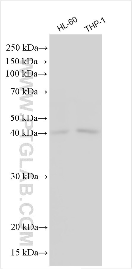 Western Blot (WB) analysis of various lysates using OSCAR Polyclonal antibody (21996-1-AP)