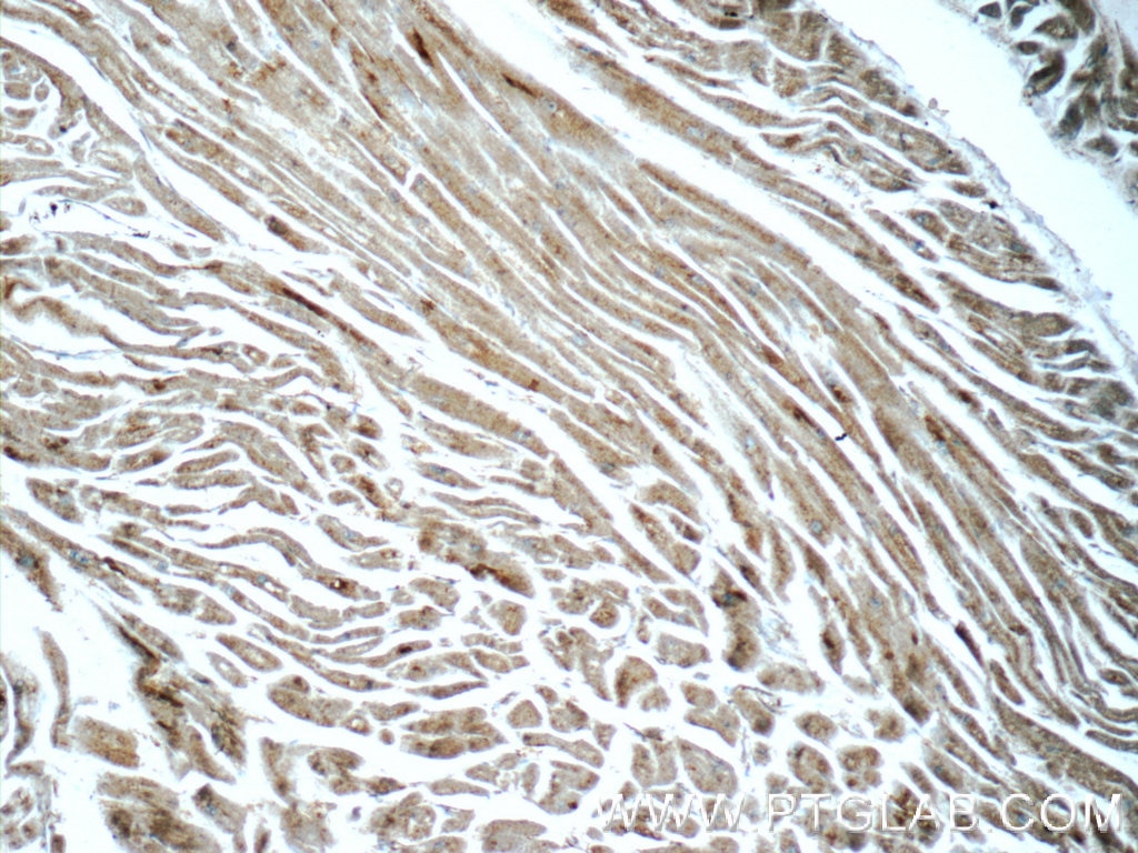 IHC staining of human heart using 15033-1-AP