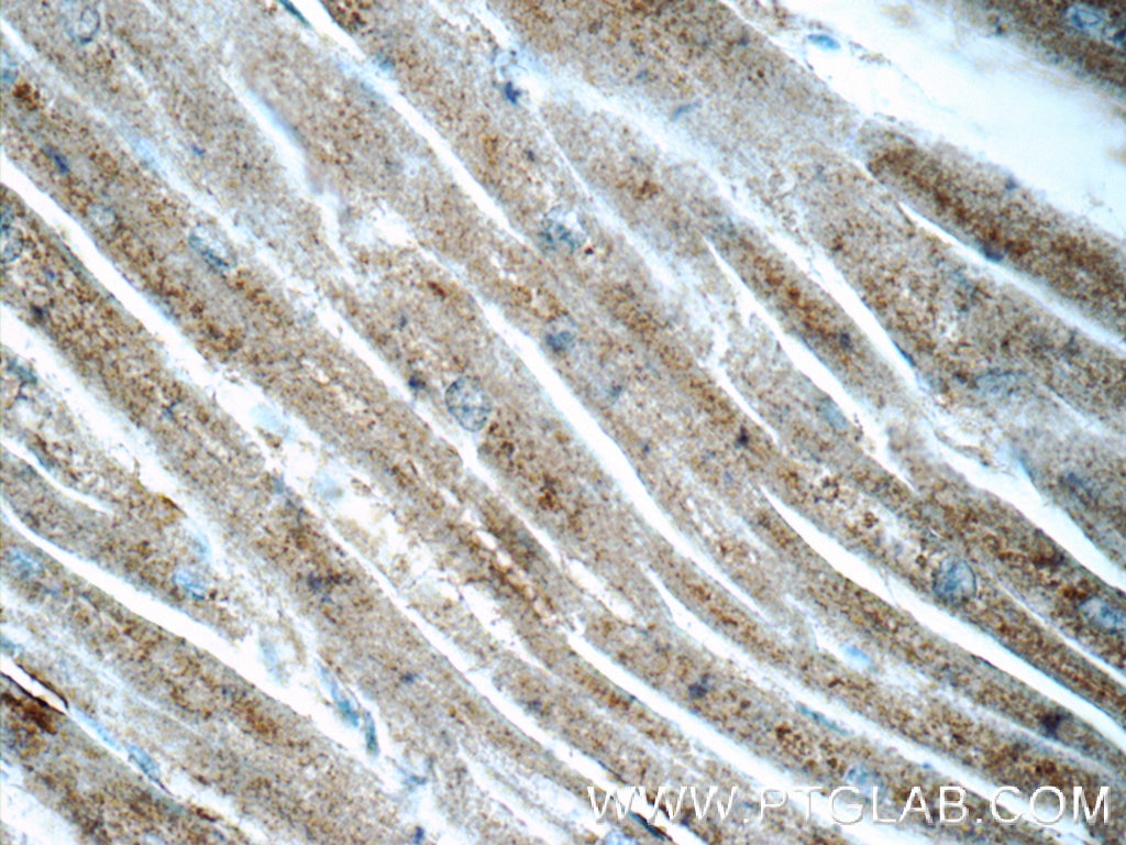 Immunohistochemistry (IHC) staining of human heart tissue using OSGEP Polyclonal antibody (15033-1-AP)