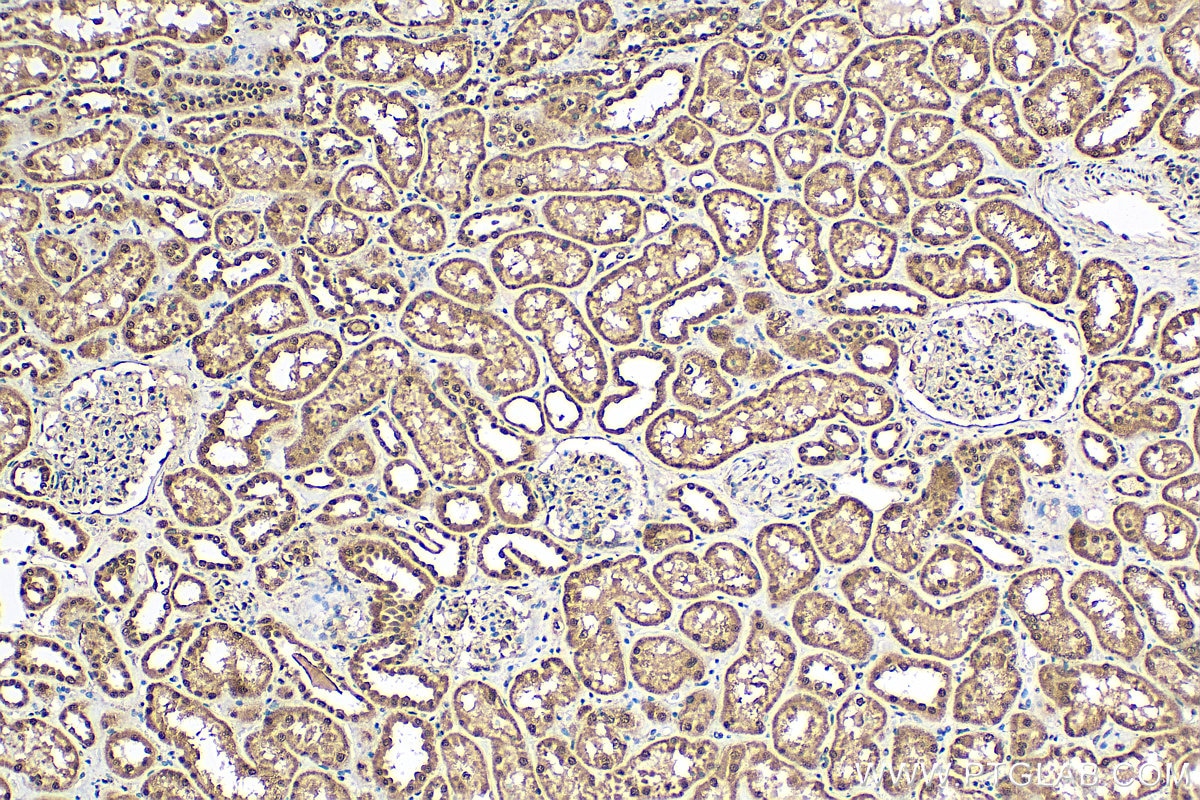 Immunohistochemistry (IHC) staining of human kidney tissue using OSGEP Polyclonal antibody (15033-1-AP)