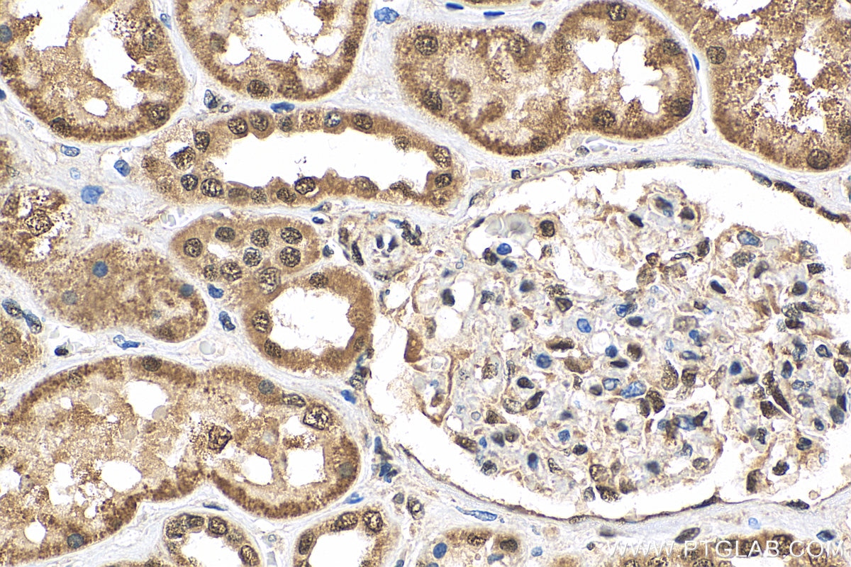 Immunohistochemistry (IHC) staining of human kidney tissue using OSGEP Polyclonal antibody (15033-1-AP)