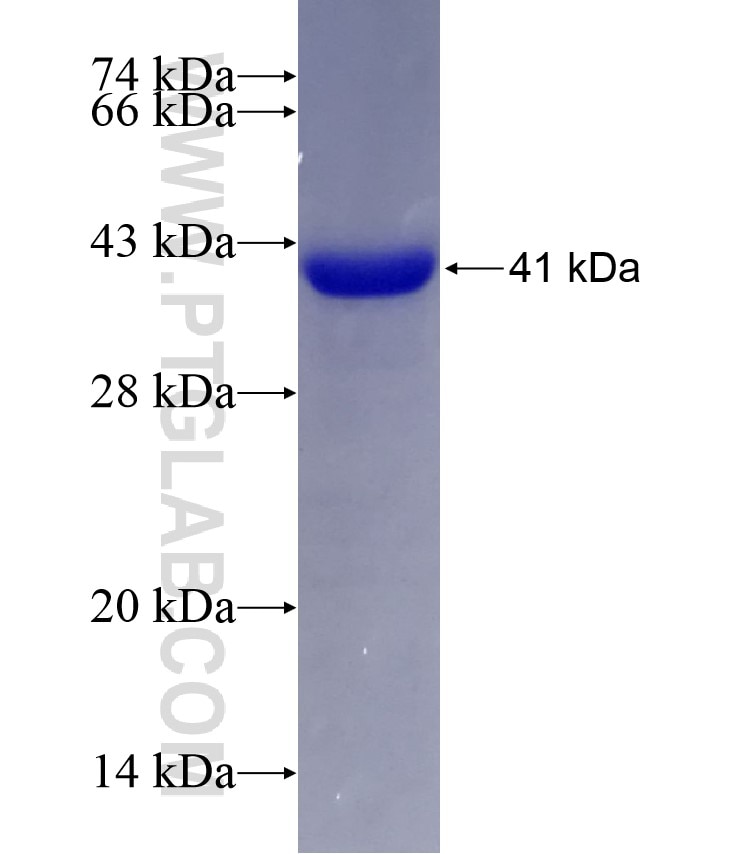 OSGEP fusion protein Ag4308 SDS-PAGE