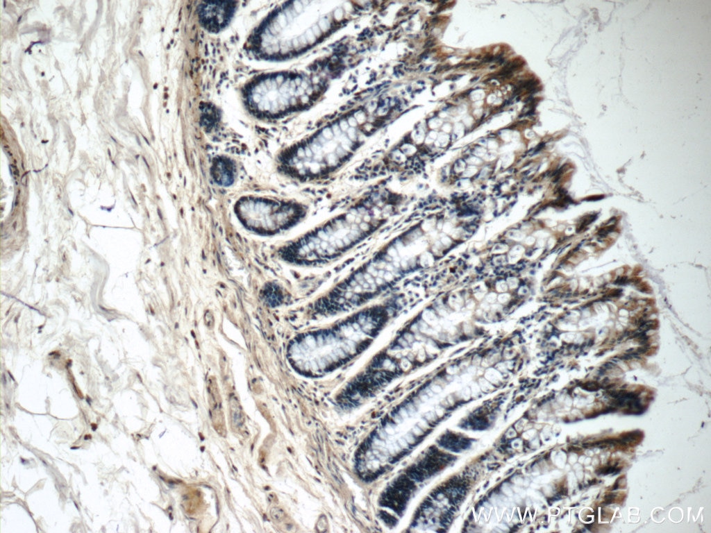 Immunohistochemistry (IHC) staining of human colon tissue using OSGEPL1 Polyclonal antibody (25694-1-AP)