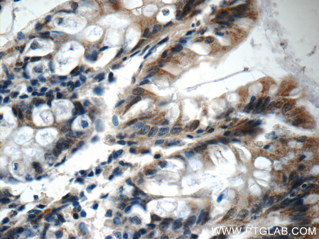 Immunohistochemistry (IHC) staining of human colon tissue using OSGEPL1 Polyclonal antibody (25694-1-AP)