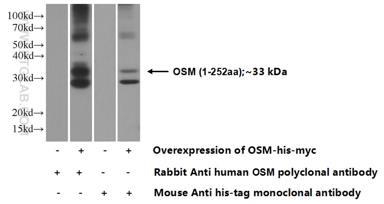 OSM Polyclonal antibody