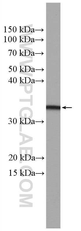 Western Blot (WB) analysis of rat testis tissue using oncostatin M Polyclonal antibody (27792-1-AP)