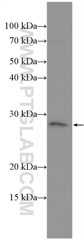 Western Blot (WB) analysis of MCF-7 cells using oncostatin M Polyclonal antibody (27792-1-AP)