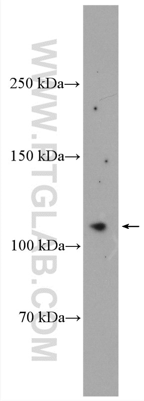 Western Blot (WB) analysis of A375 cells using OSMR Polyclonal antibody (10982-1-AP)