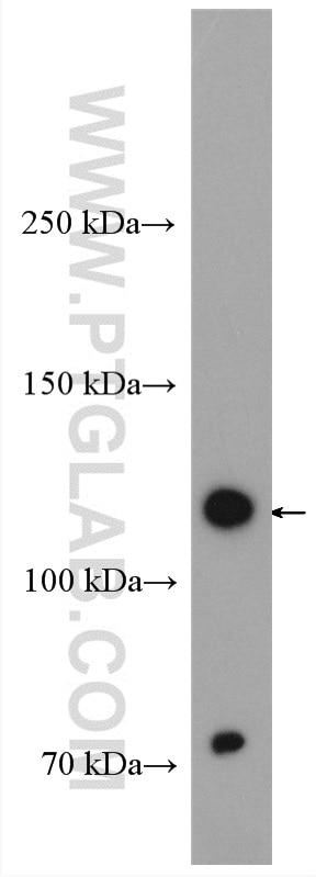 Western Blot (WB) analysis of HEK-293T cells using OSMR Polyclonal antibody (10982-1-AP)