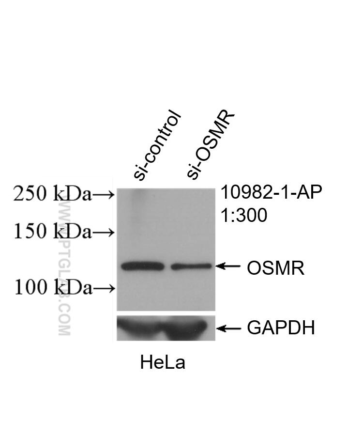 Western Blot (WB) analysis of HeLa cells using OSMR Polyclonal antibody (10982-1-AP)