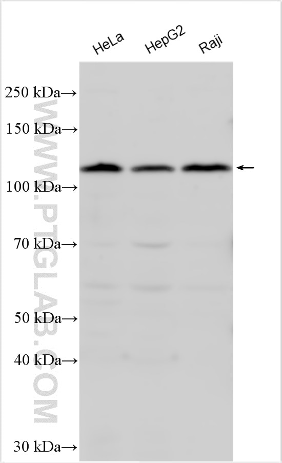 Western Blot (WB) analysis of various lysates using OSMR Polyclonal antibody (10982-1-AP)