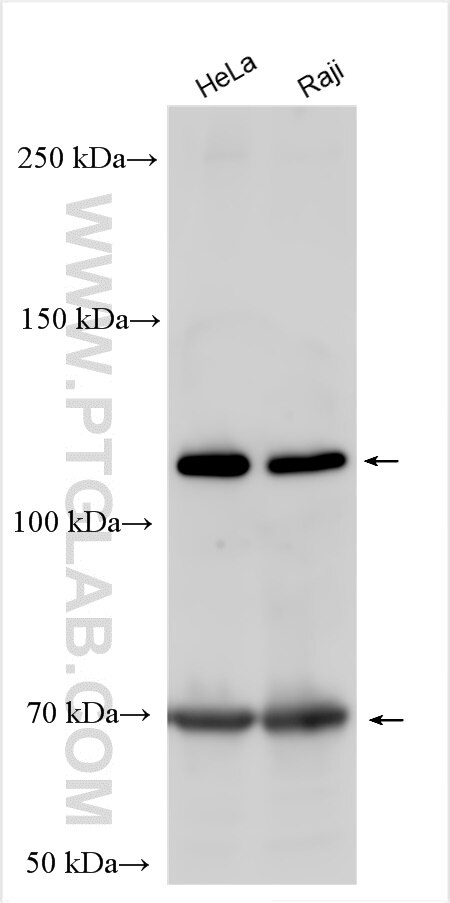 Western Blot (WB) analysis of various lysates using OSMR Polyclonal antibody (10982-1-AP)