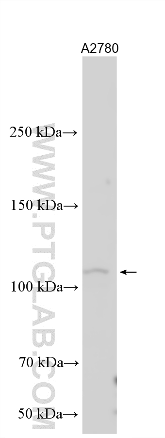 Western Blot (WB) analysis of various lysates using OSMR Polyclonal antibody (10982-1-AP)
