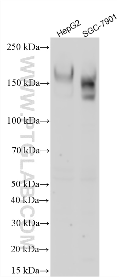 WB analysis using 10982-1-AP Western Blot (WB) analysis of various lysates using OSMR Polyclonal antibody (10982-1-AP)