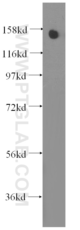 Western Blot (WB) analysis of human brain tissue using OSMR Monoclonal antibody (60071-1-Ig)