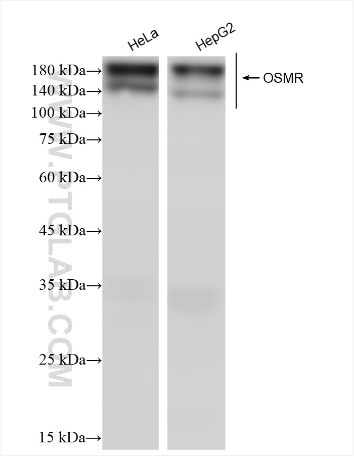 Western Blot (WB) analysis of various lysates using OSMR Recombinant antibody (84555-1-RR)