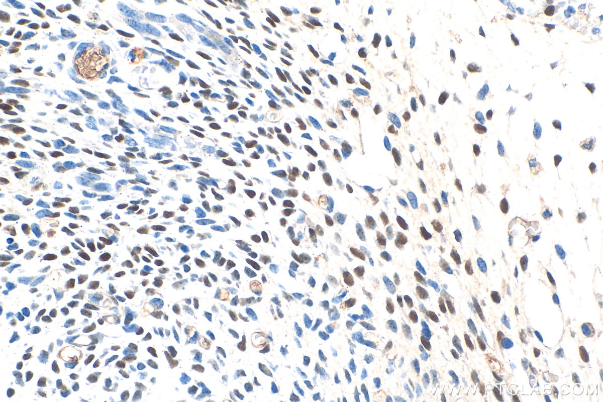 Immunohistochemistry (IHC) staining of mouse embryo tissue using OSR1 Polyclonal antibody (30606-1-AP)