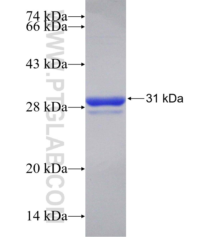 OSR1 fusion protein Ag31336 SDS-PAGE