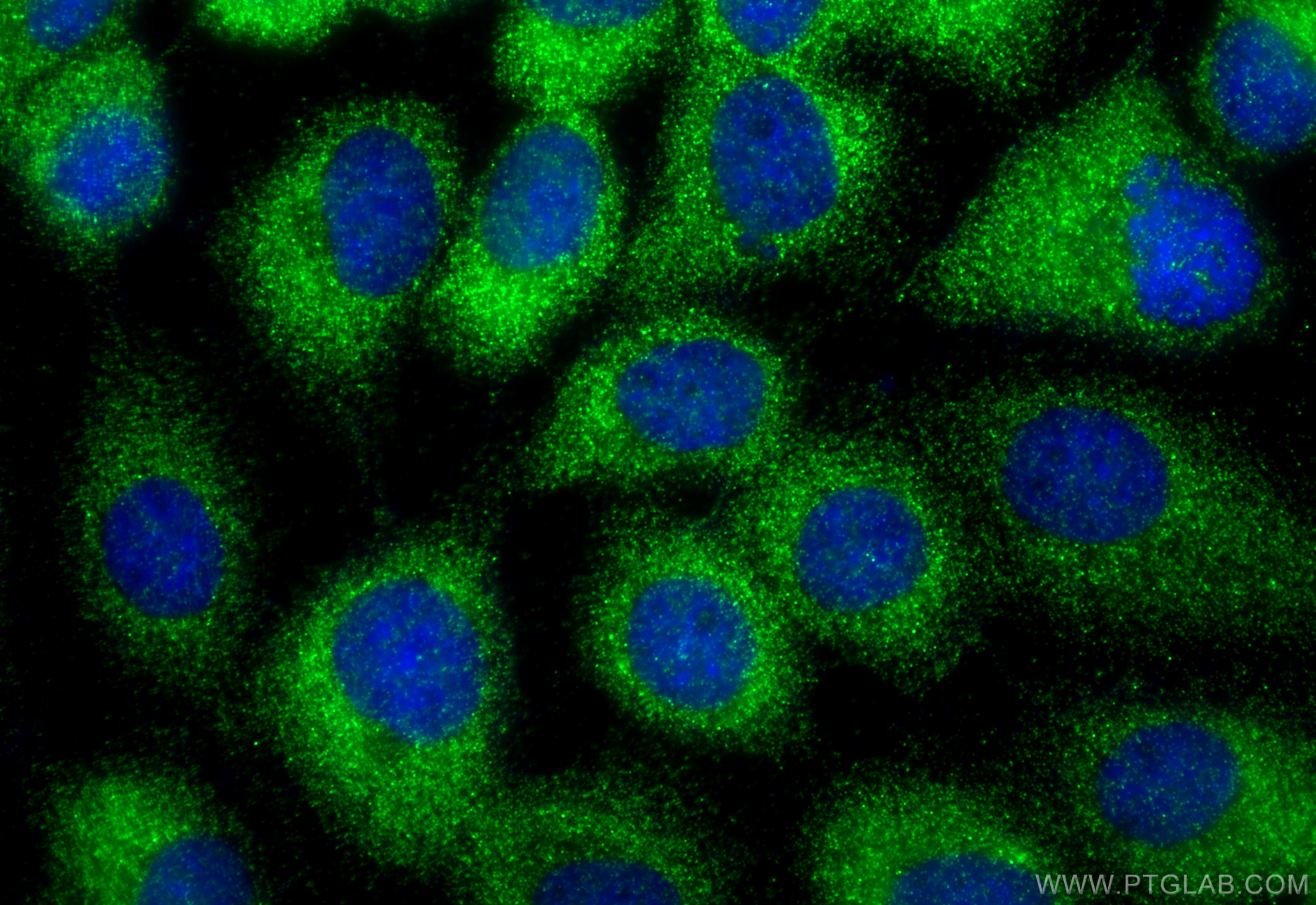 Immunofluorescence (IF) / fluorescent staining of A431 cells using OSTF1 Polyclonal antibody (10671-1-AP)