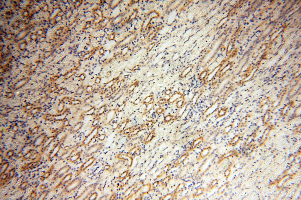 Immunohistochemistry (IHC) staining of human kidney tissue using OSTF1 Polyclonal antibody (10671-1-AP)