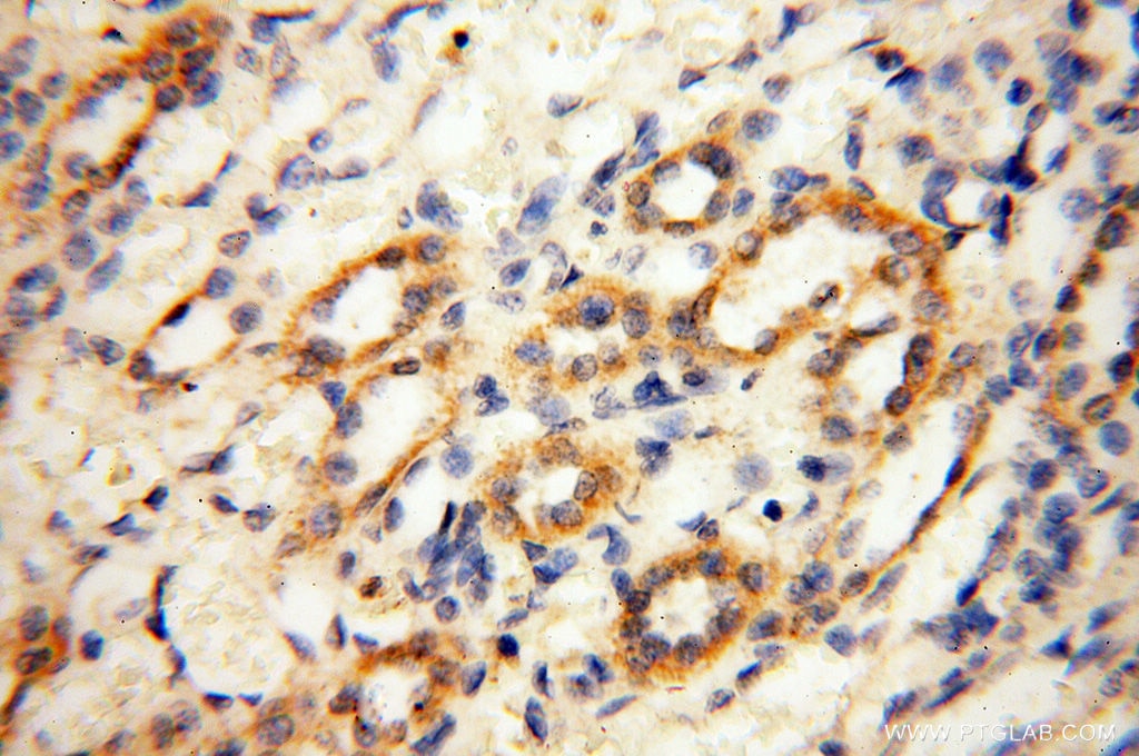 IHC staining of human kidney using 10671-1-AP
