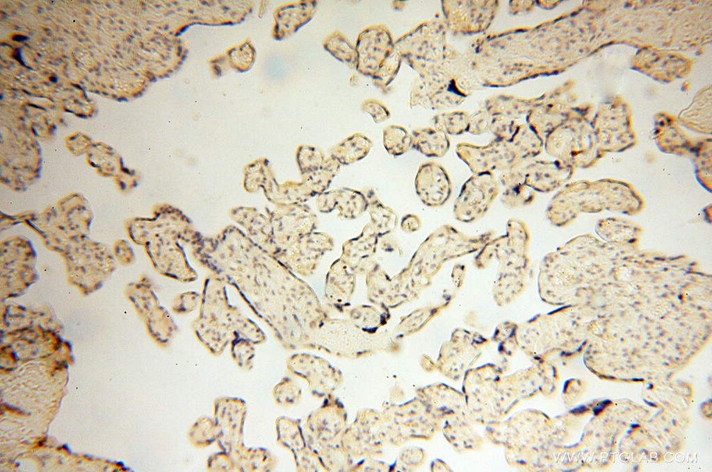 Immunohistochemistry (IHC) staining of human placenta tissue using OSTF1 Polyclonal antibody (10671-1-AP)