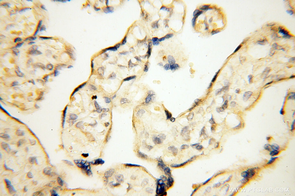 Immunohistochemistry (IHC) staining of human placenta tissue using OSTF1 Polyclonal antibody (10671-1-AP)