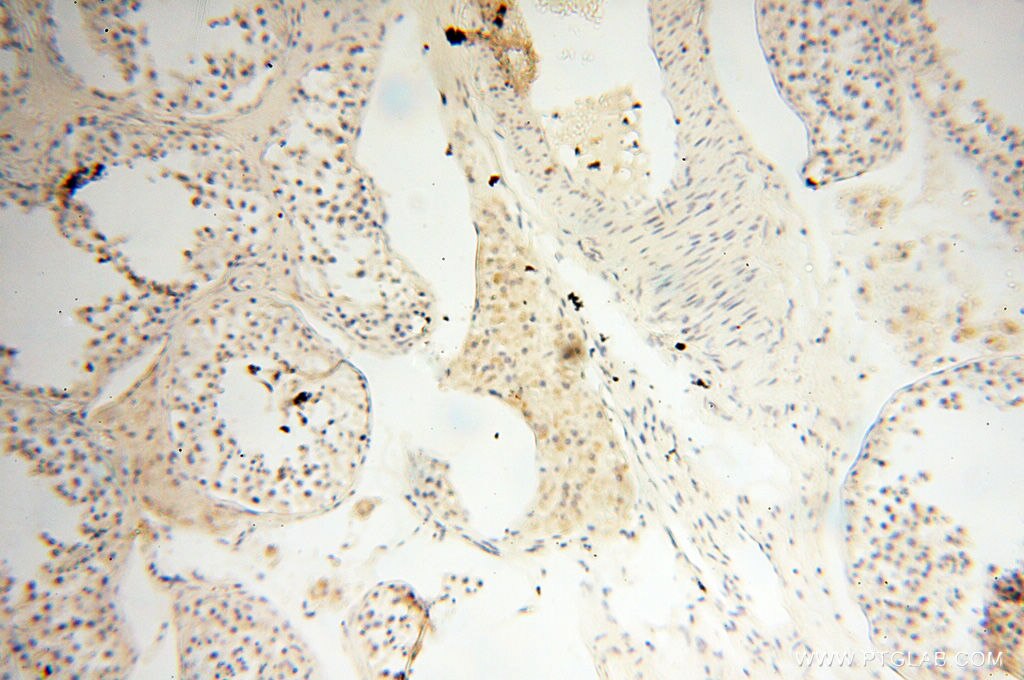 Immunohistochemistry (IHC) staining of human testis tissue using OSTF1 Polyclonal antibody (10671-1-AP)