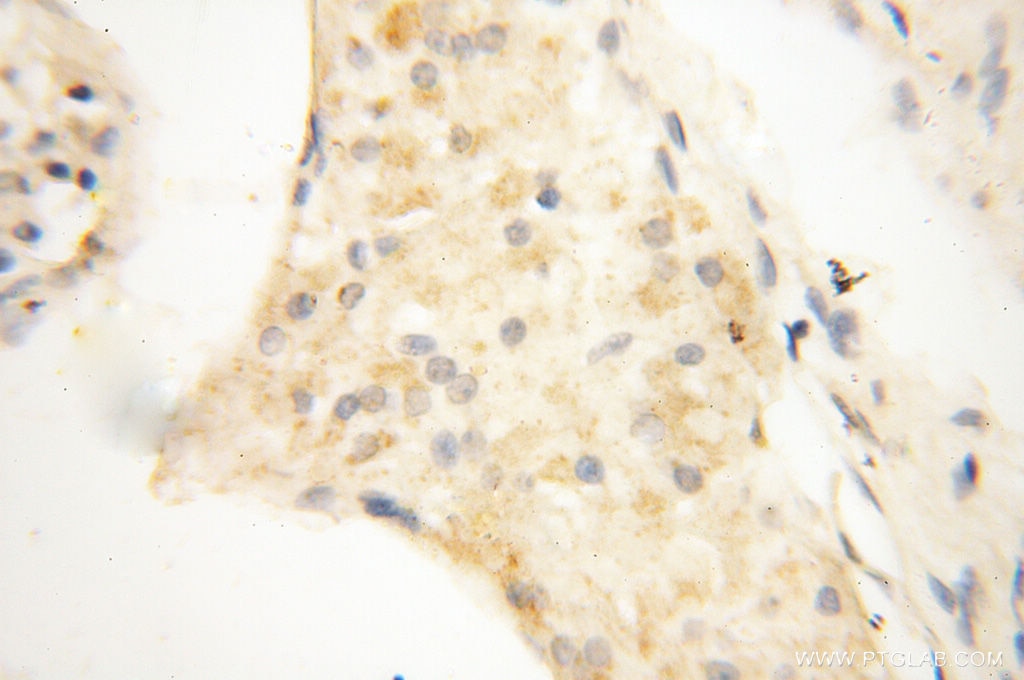 IHC staining of human testis using 10671-1-AP